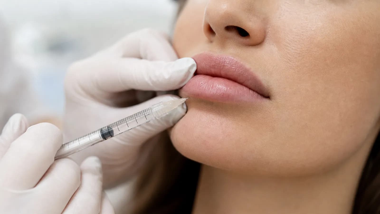 Dermal filler injection performed at a cosmetic dermatology clinic