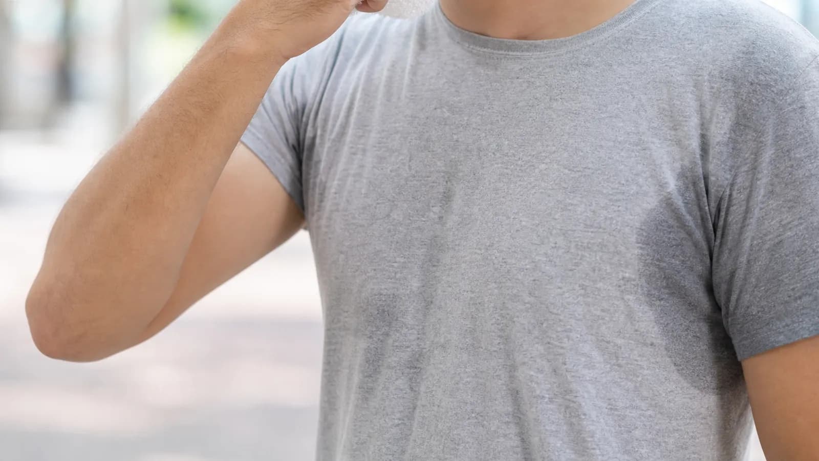 In-office treatment consultation for excessive sweating