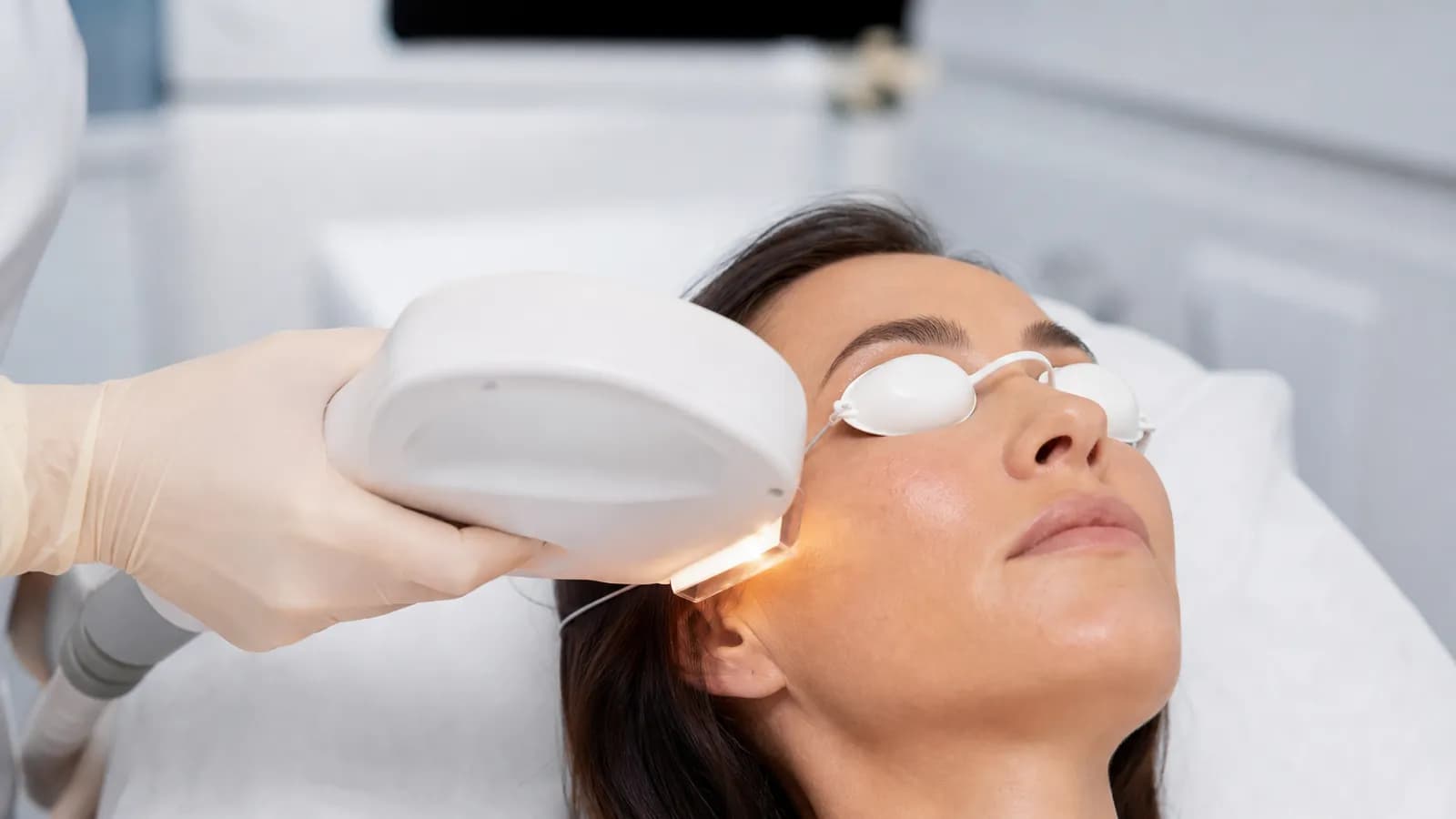 IPL photofacial treatment for sun damage and facial redness
