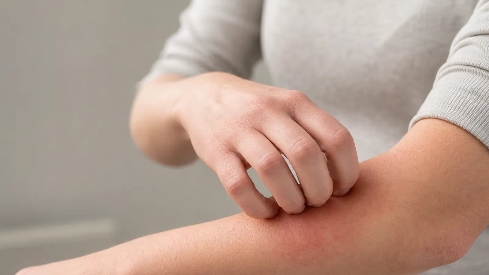 Dermatologist examining a skin rash on a patient’s arm