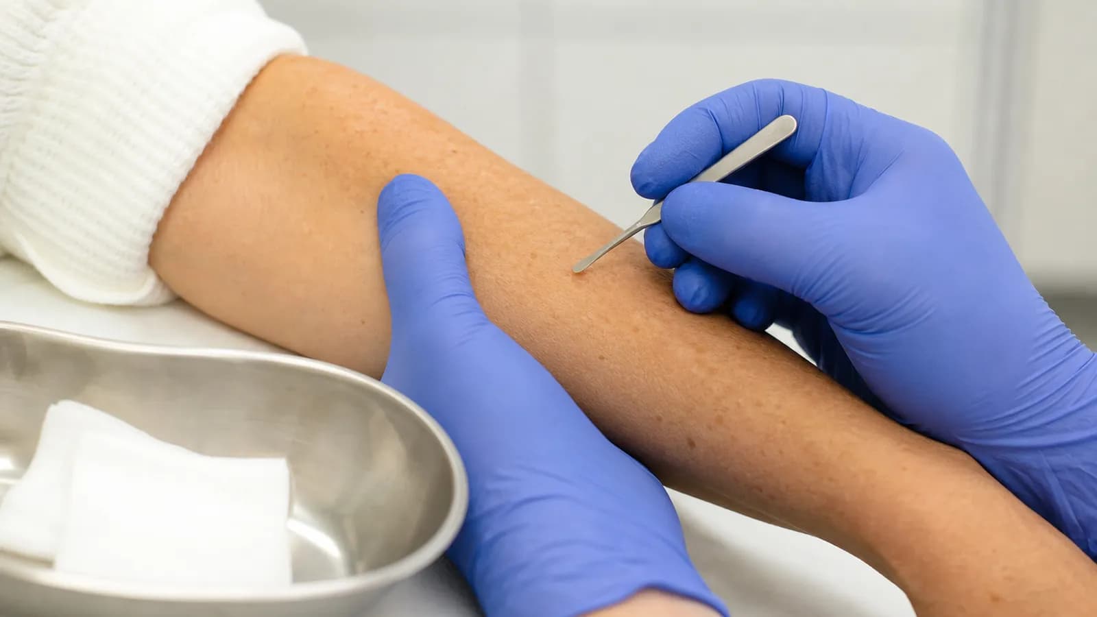 Dermatologist preparing sterile instruments for a skin biopsy